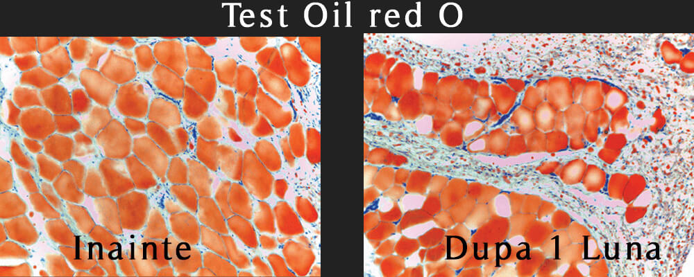 Inainte si dupa Test-Oil-Red-O