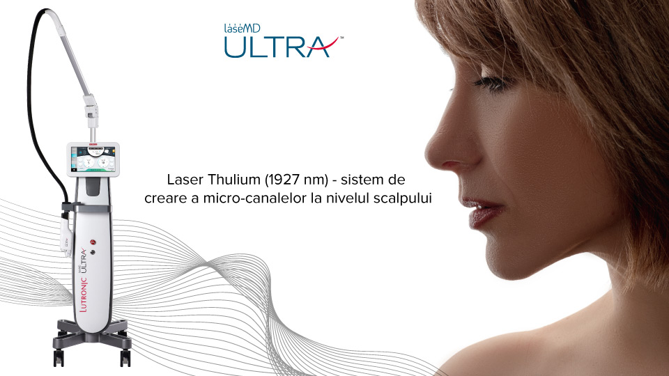 Laser Thulium (1927 nm) - sistem de creare a micro-canalelor la nivelul scalpului